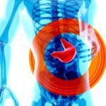 Kidney disease Chronic kidney disease Dialysis treatment